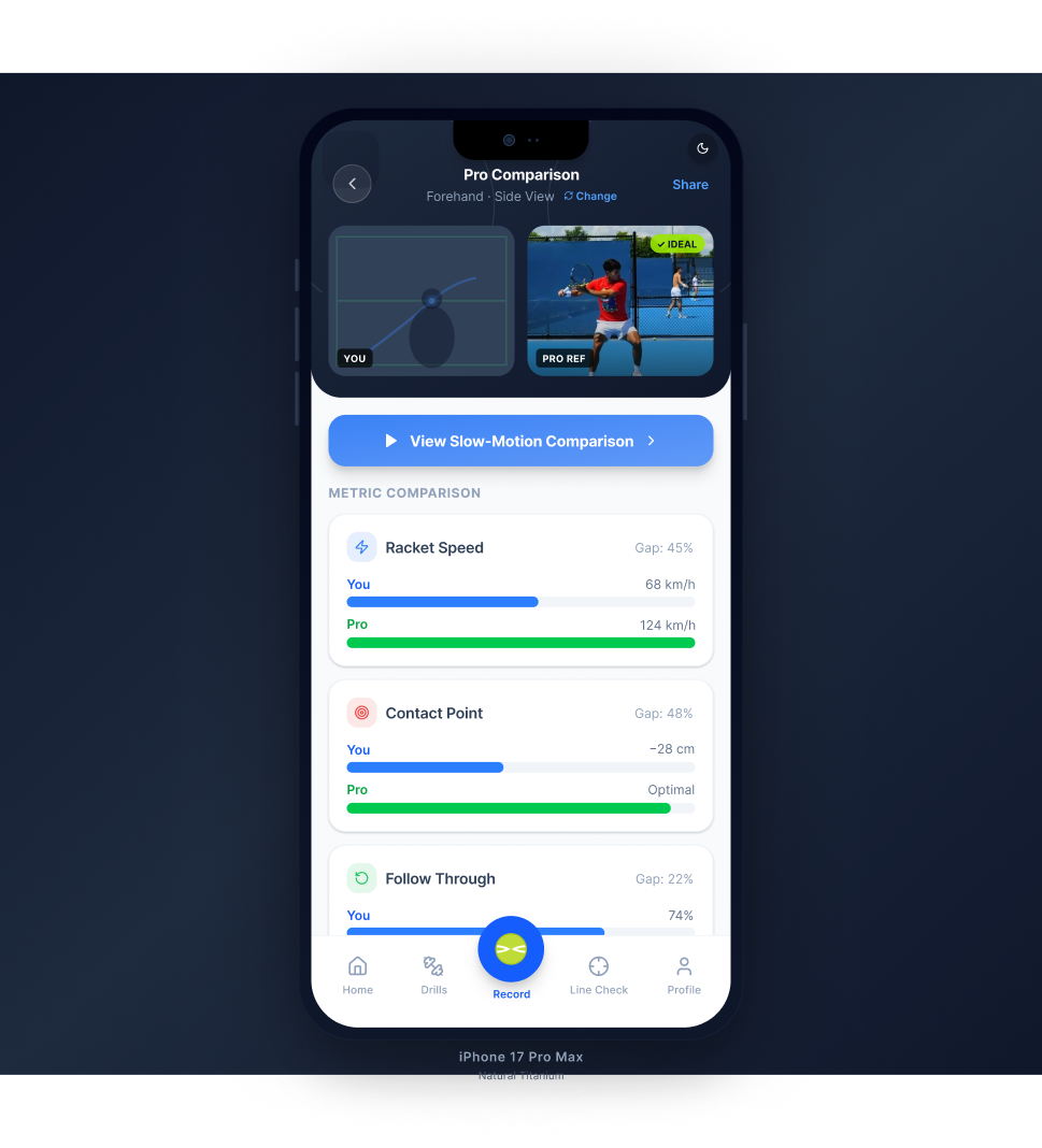 Pro comparison
